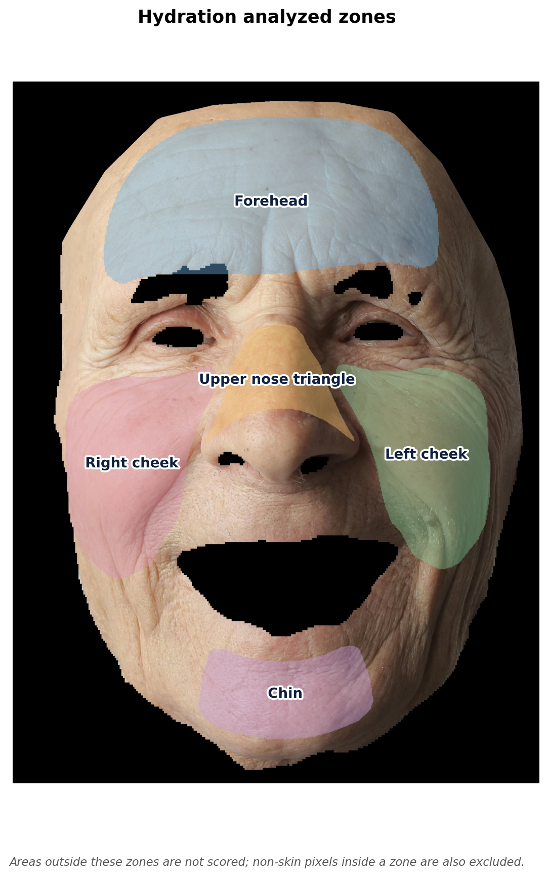 The five hydration zones overlaid on a face: forehead, upper nose triangle, left cheek, right cheek, and chin
